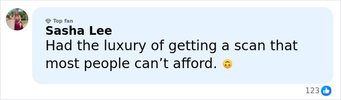 User Sasha Lee commenting about getting a brain scan that most people cannot afford, with a thinking face emoji.