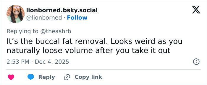 Comment discussing Kelly Osbourne's transformation mentioning buccal fat removal and its effects on facial volume.