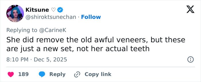 Tweet discussing Miley Cyrus’s youthful glow and viral makeover after removing old veneers and getting a new set of teeth.