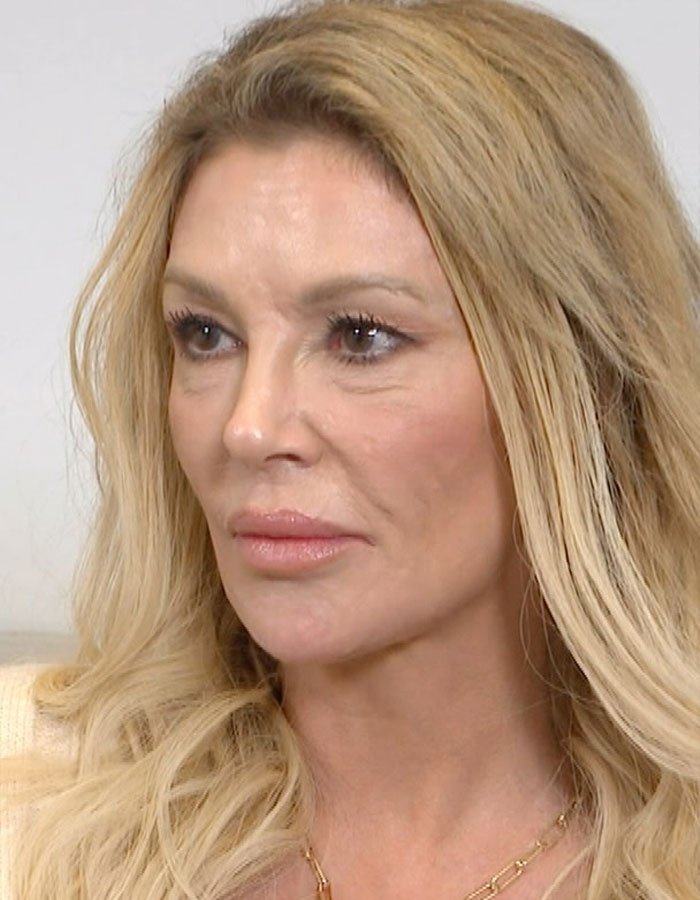 Brandi Glanville with blonde hair and natural makeup, discussing facial disfigurement diagnosis in an indoor setting.