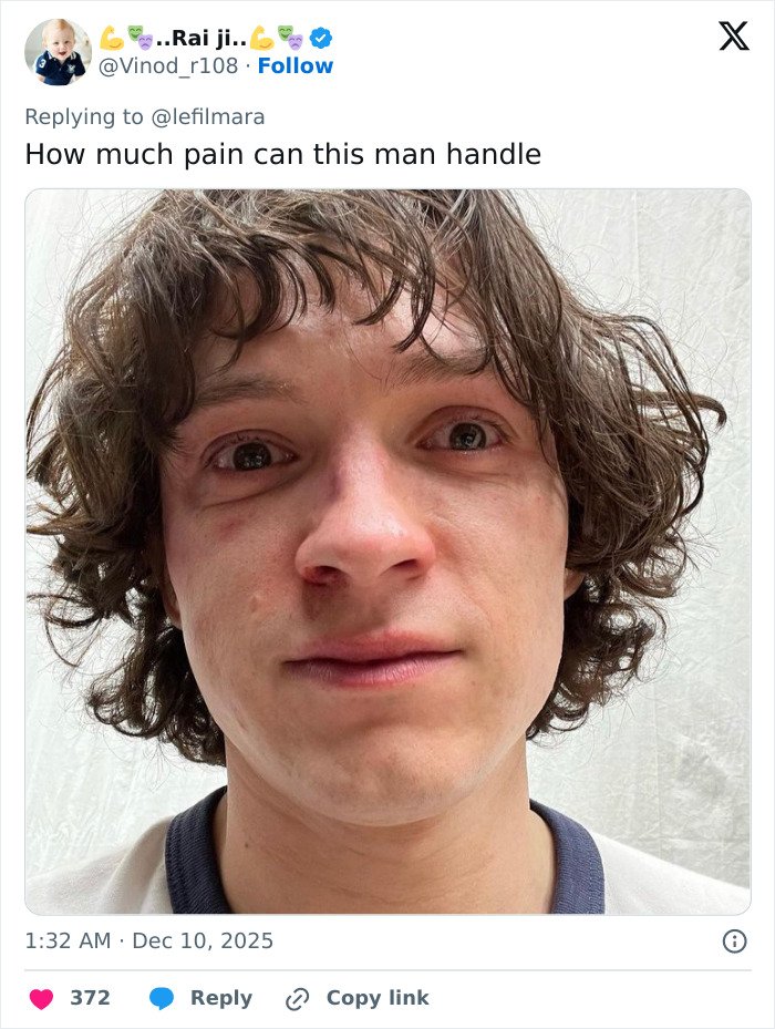 Close-up of a young man with messy hair and a bruised face reacting to Robert Pattinson and Zendaya's viral engagement ad.
