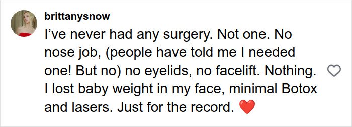 Alt text: Brittany Snow’s blunt response to plastic surgery rumors denying nose jobs and facelifts amid netizens’ comments on noses.