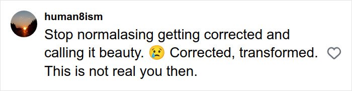 Alt text: Social media comment discussing plastic surgery rumors about Britanny Snow and reactions about authenticity.