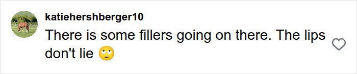 Screenshot of a social media comment discussing fillers and lip appearance related to plastic surgery rumors.