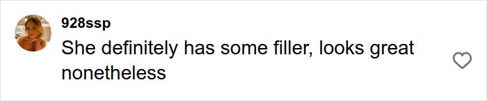 User comment on social media about plastic surgery rumors, mentioning filler and complimenting appearance.