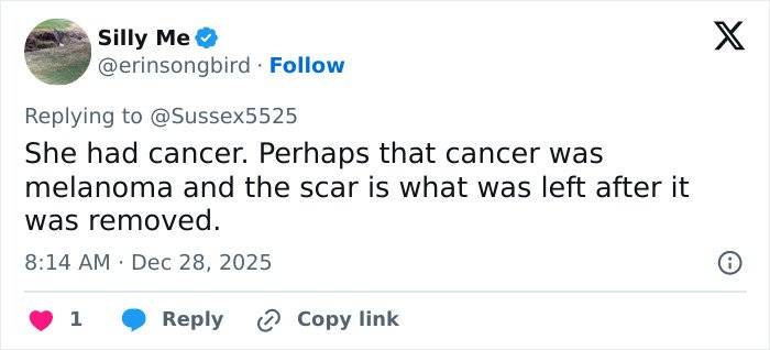 Tweet discussing Kate Middleton's scar during Christmas appearance fueling cancer and conspiracy theories online.