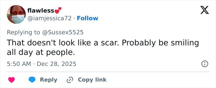 Screenshot of a tweet discussing Kate Middleton's scar during Christmas appearance sparking conspiracy theories.