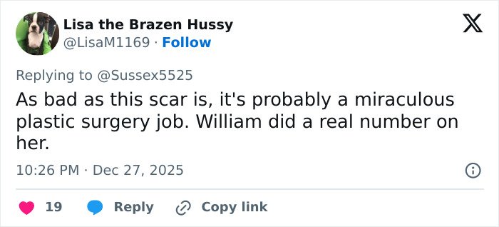 Tweet discussing Kate Middleton’s scar, prompting wild conspiracy theories about her never having cancer.