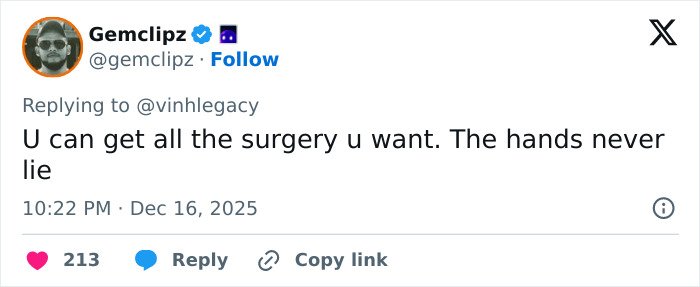 Social media post referencing the hands never lie phrase related to Kris Jenner’s viral $100k facelift discussion.