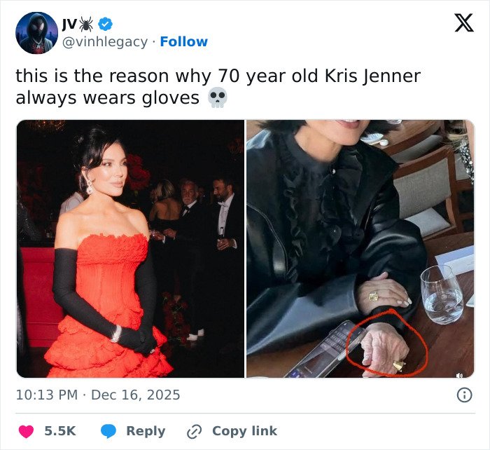 Kris Jenner ditches gloves in public revealing hands after viral $100k facelift discussions with close-up on aged hands.