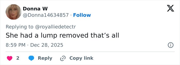 Screenshot of a Twitter reply discussing Kate Middleton’s facial scar and its link to her 2024 hospitalization rumors.