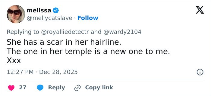 Tweet discussing Kate Middleton’s facial scar and rumors about the severity of her 2024 hospitalization.