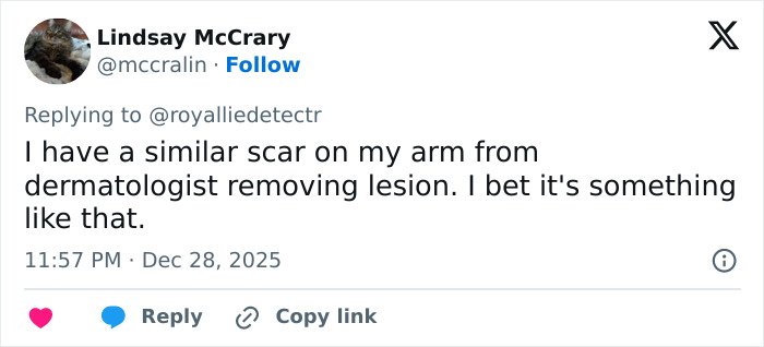 Twitter comment discussing a facial scar related to Kate Middleton’s 2024 hospitalization rumors.