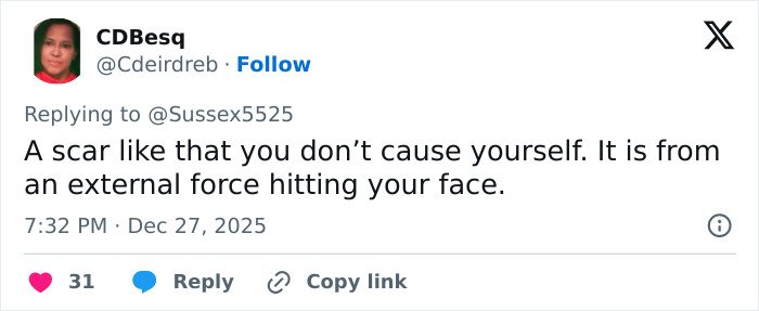 Tweet discussing Kate Middleton’s facial scar and its link to rumors about the severity of her 2024 hospitalization.