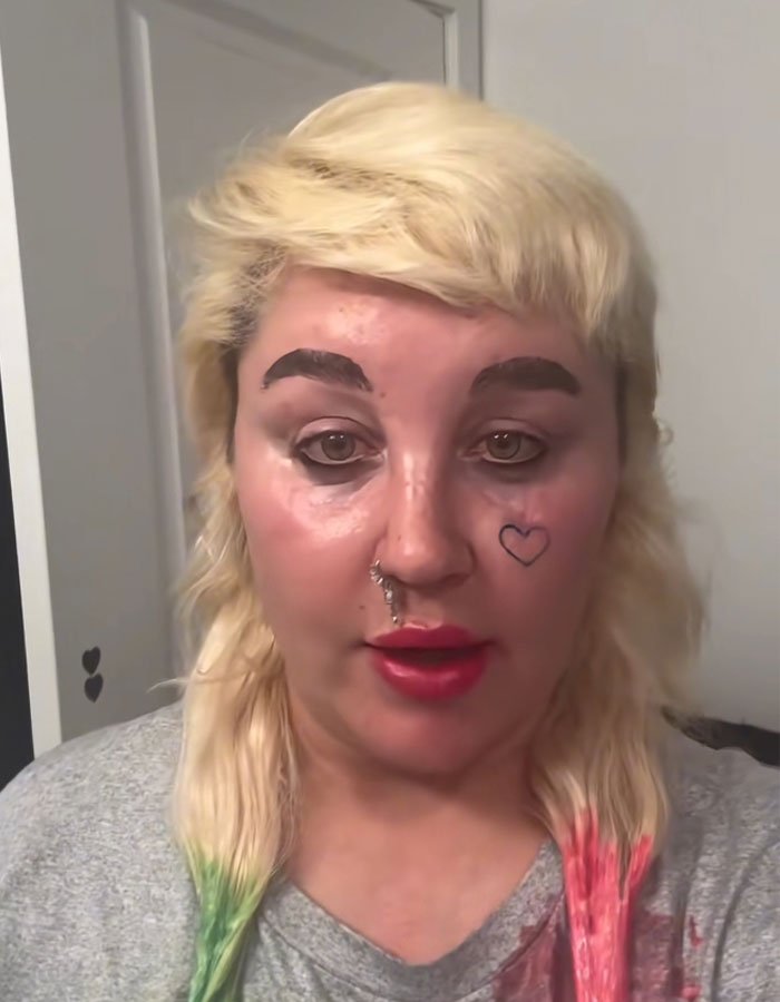 Amanda Bynes with colorful hair tips and face tattoo, discussing injections after dramatic weight loss Paparazzi pic revealed