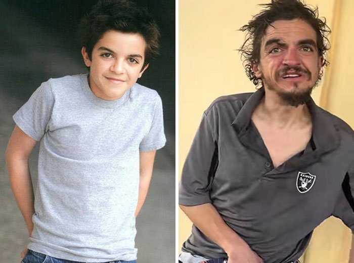 Side-by-side photos showing Tylor Chase before and after hospitalization, highlighting his health decline revealed by a friend.