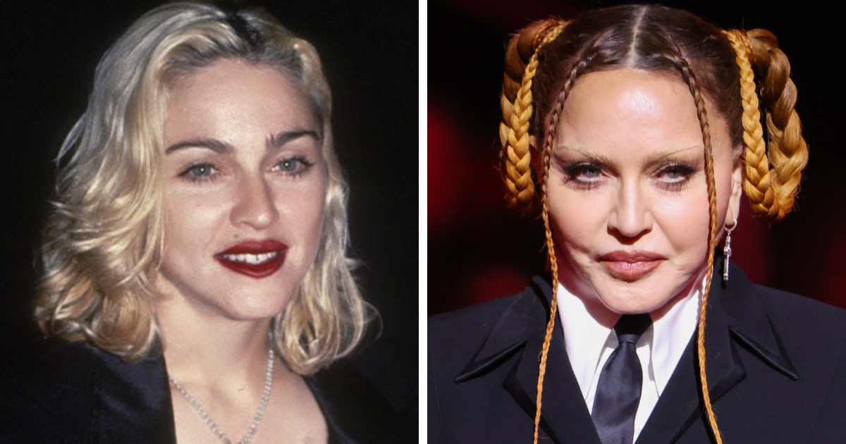 20 Celebrities Who Learned The Hard Way About Plastic Surgery