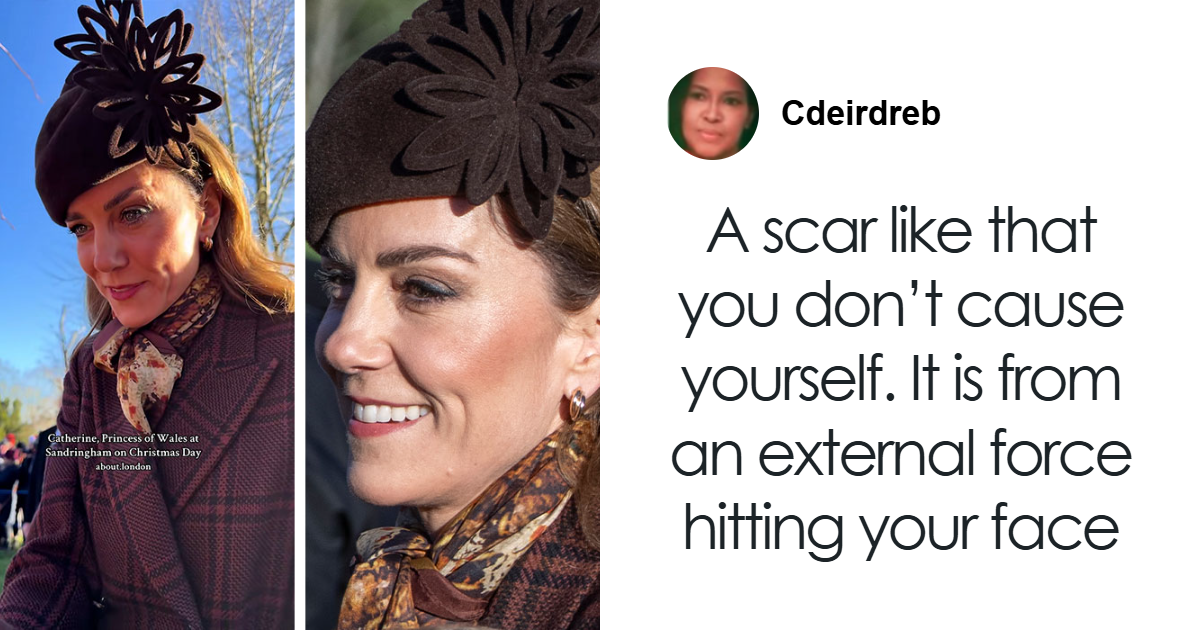 “Never Had Cancer”: Video Of Kate Middleton’s “Scar” During Christmas Appearance Sparks Wild Conspiracy Theories