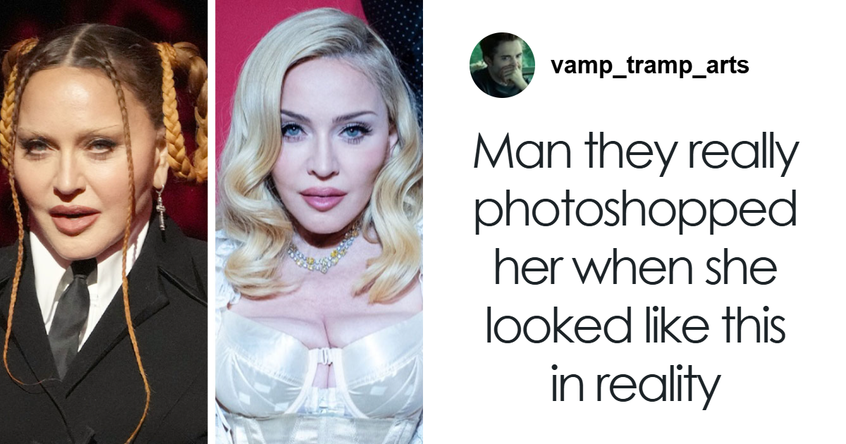 “They Really Photoshopped Her”: Madonna’s Holiday Lingerie Photoshoot Sparks Frenzy