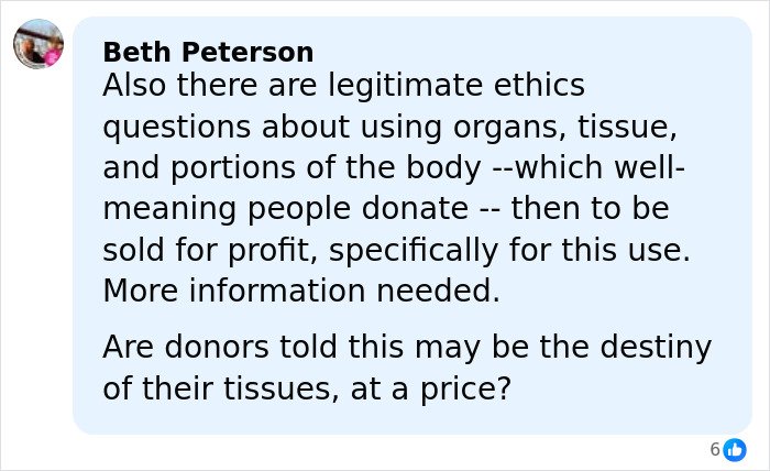 Comment discussing ethical concerns about using donated lifeless bodies for BBLs and breast implants in medical procedures.