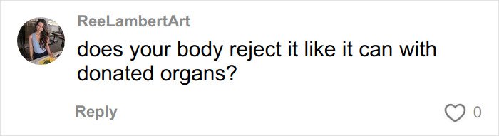 Comment asking if the body rejects donated organs like it might with lifeless bodies used for BBLs and breast implants.