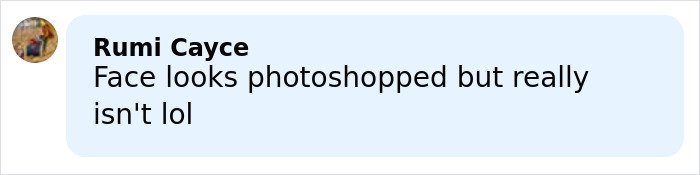 Comment on Amy Schumer trolling herself shortly after divorce filing amid backlash over bikini photos.