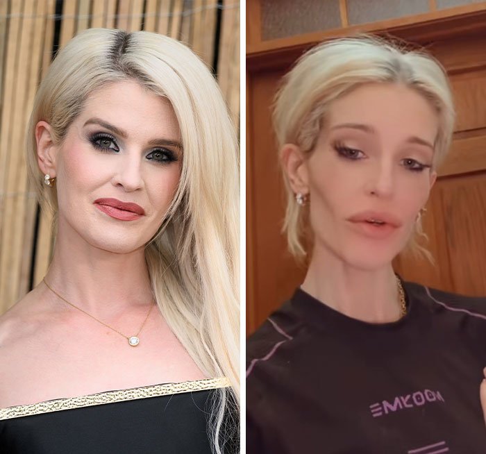 Kelly Osbourne in two side-by-side images showing her appearance change, fans urging her to seek help.