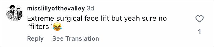 Screenshot of an Instagram comment discussing extreme surgical face lift and mentioning no filters with a laughing emoji.