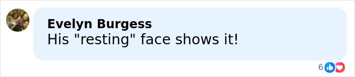Comment on social media post discussing droopy face and health speculation about Trump, expressing belief in the resting face explanation.