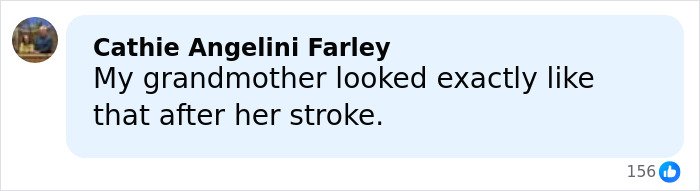 Comment mentioning stroke symptoms related to droopy face, reflecting health speculation about Trump discussed by a doctor.