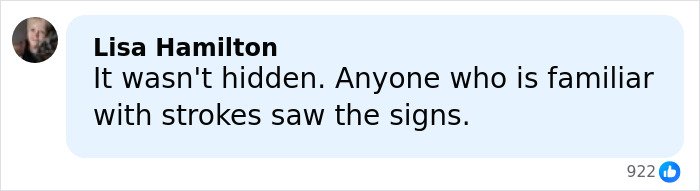 Comment by Lisa Hamilton discussing stroke signs in relation to a health speculation about a droopy face.