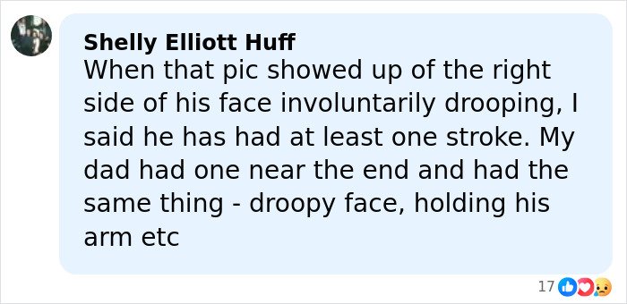 Comment discussing concerns about droopy face and health speculation related to possible stroke symptoms.