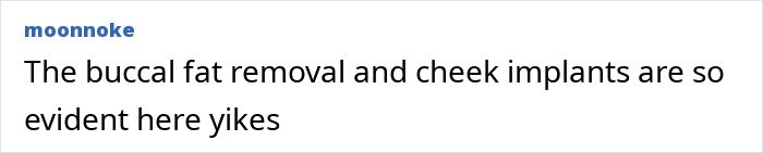 Comment stating buccal fat removal and cheek implants are evident, referencing fans blaming plastic surgery on Selena Gomez's transformation.