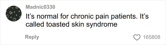 Screenshot of a social media comment explaining toasted skin syndrome as common for chronic pain patients.