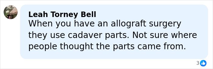 Comment about allograft surgery using cadaver parts for breast implants and BBL procedures, clarifying tissue sources.