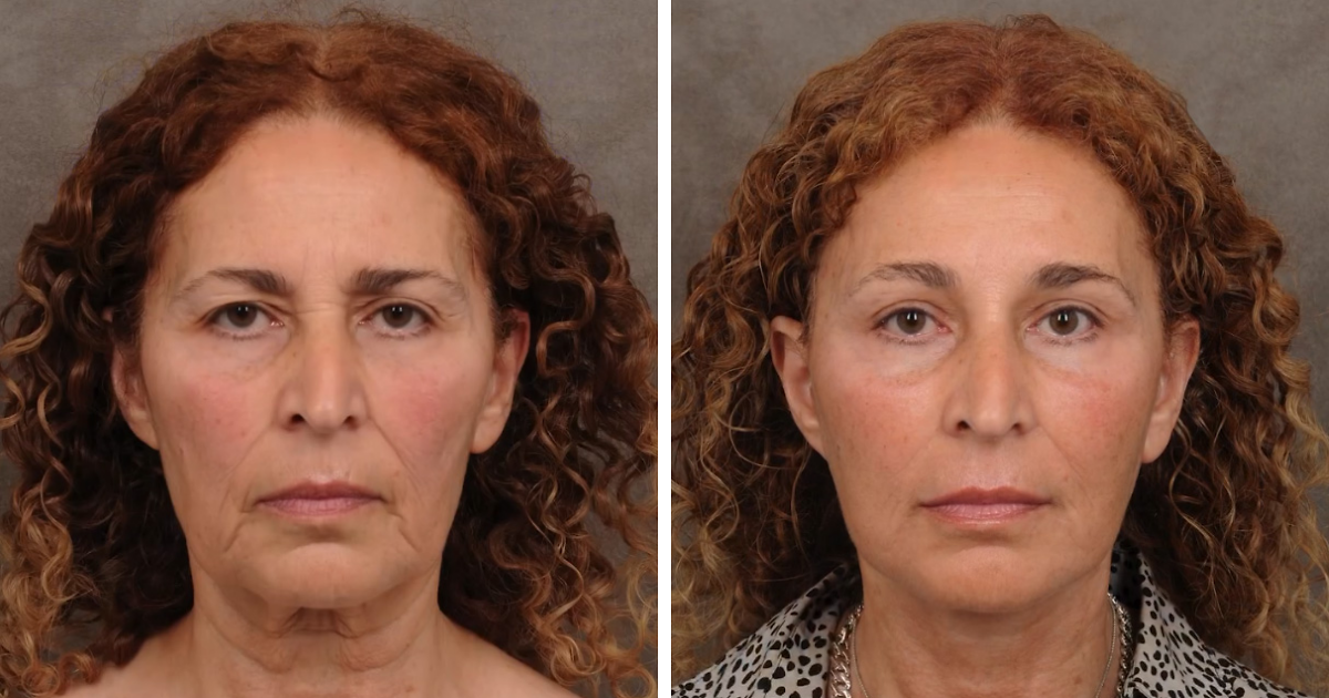 Plastic Surgeon’s Blunt Response To Criticism On Before-And-After Reveal Goes Viral