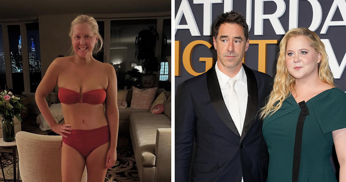 Amy Schumer Trolls Herself Shortly After Divorce Filing Amid Backlash Over Bikini Photos