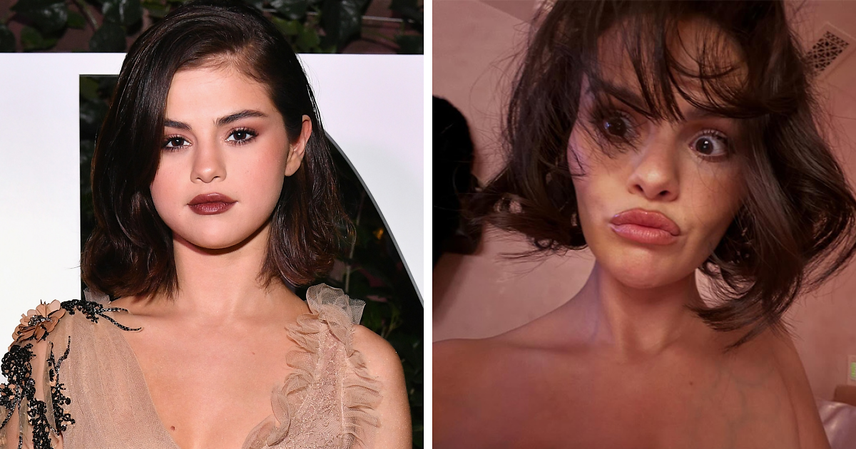 Fans Blame Plastic Surgery For Selena Gomez’s “Unhinged” Transformation In Recent Snaps