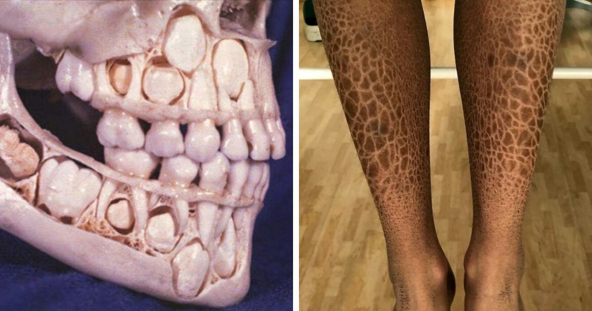 80 Fascinating And Unnerving Medical Photos Not Everyone Can Handle