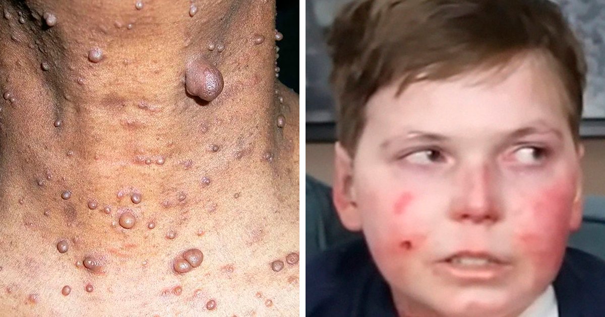 36 Diseases That Are The Worst Of The Worst