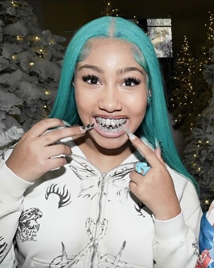 Young woman with turquoise hair showing embellished teeth grill, highlighting North West's recent piercings controversy seen by fans.