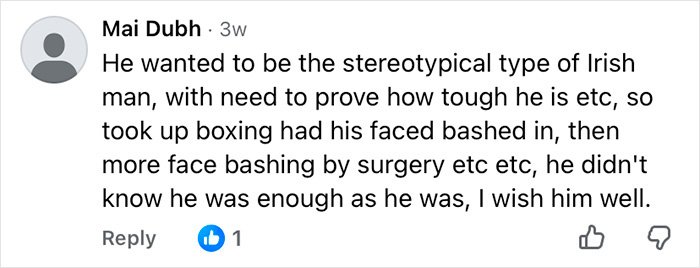 Comment on Mickey Rourke's appearance and cosmetic procedures reflecting changes without dramatic surgery.