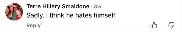 Comment on social media post about Mickey Rourke, reflecting opinions on his appearance without cosmetic procedures.