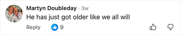 Comment by Martyn Doubleday stating he has just gotten older like everyone else, related to Mickey Rourke cosmetic procedures.
