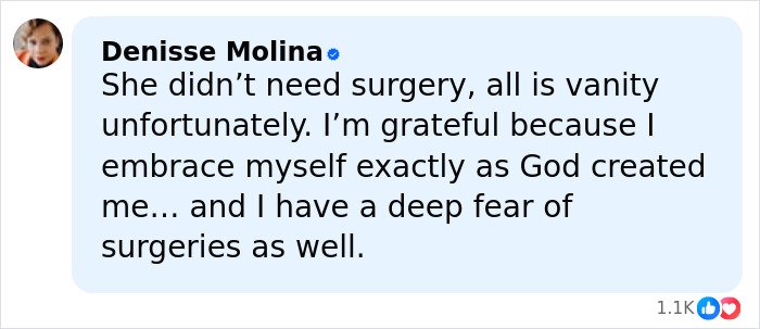 Comment from verified user Denisse Molina expressing fear of surgeries and valuing natural beauty over plastic surgery risks.
