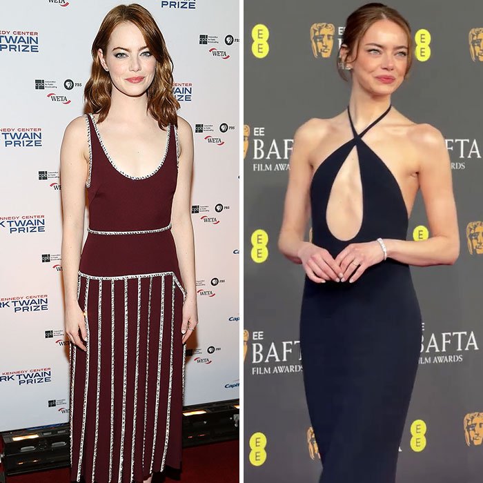 Emma Stone at the 2026 BAFTAs wearing a black dress, appearing notably cadaverous and sparking major concerns.