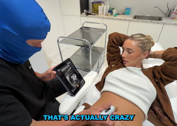 Participant from Bonnie Blue’s 400-Men Challenge undergoing a medical scan, revealing behind-the-scenes moments in a clinical setting.