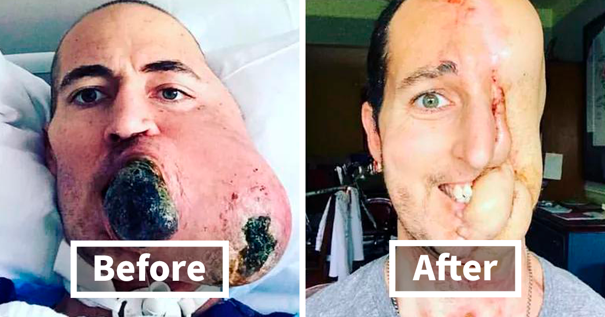 26 Interesting Medical Cases That Might Make You Appreciate The Human Body
