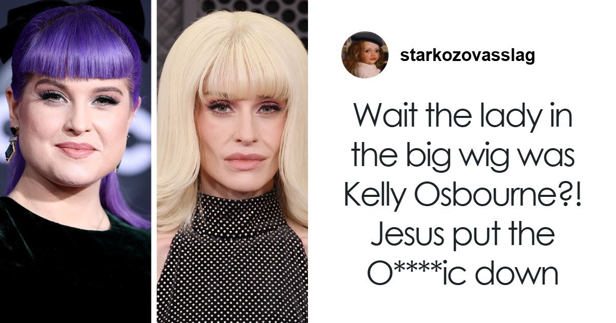 “How Is This Possible?”: Frenzy Over Botched Plastic Surgery And Weight Loss After The Grammys
