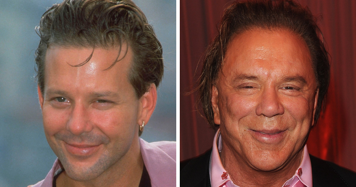 How Mickey Rourke Would Look Today Without His Dramatic Cosmetic Procedures